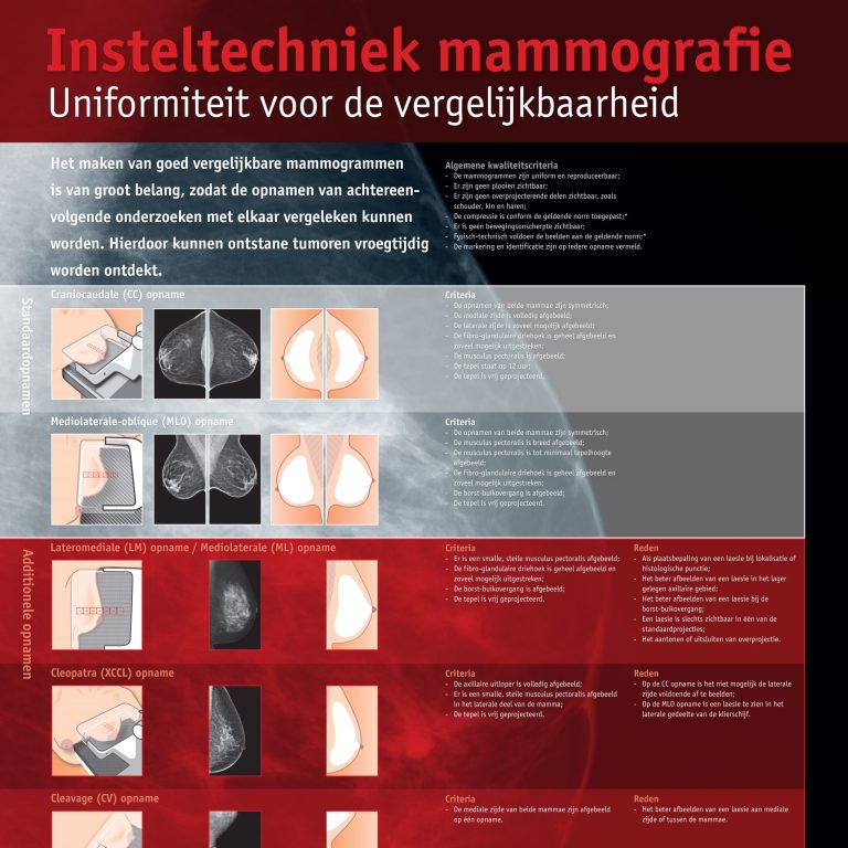 Poster 'Insteltechniek mammografie: Uniformiteit voor de vergelijkbaarheid'