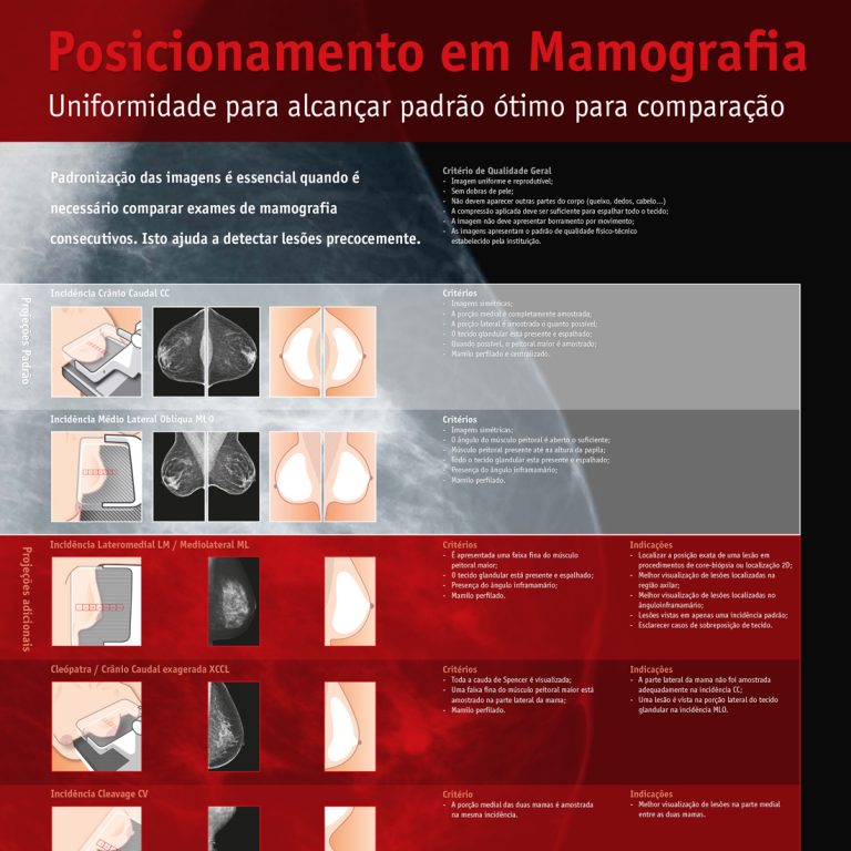 Poster ‘Posicionamento em Mamografia: Uniformidada para alcancar padrrão ótimo para comparacão’