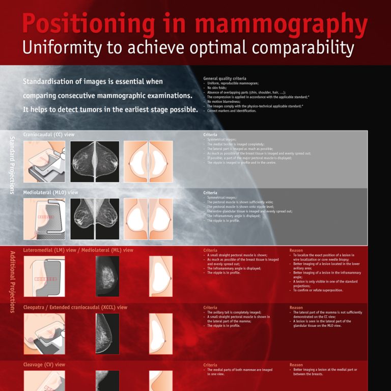 Poster ‘Positioning in Mammography: Uniformity to achieve optimal comparability’